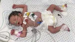 Gazze'de insanlık dramı büyüyor! 'Bebek ölümleri görülebilir’