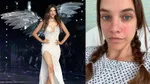 Barbara Palvin'in Şok Hastalığı! Meğer Ameliyat Bile Olmuş!
